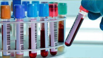 ¿cual es el grupo sanguineo mas vulnerable al coronavirus? ¿cual es el grupo sanguineo mas vulnerable al coronavirus?