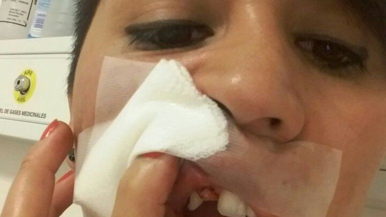 A Cintia le rompieron un diente de un piedrazo mientras iba en auto.