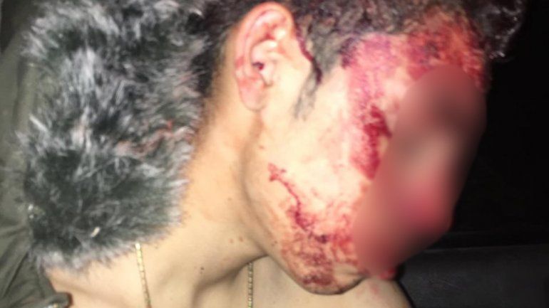 Denuncian que intentaron subir a un adolescente a una camioneta y le provocaron cuatro cortes en la cabeza