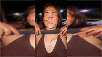 El ataque ocurrió en en plena calle del B° Obrero A de Cipolletti.