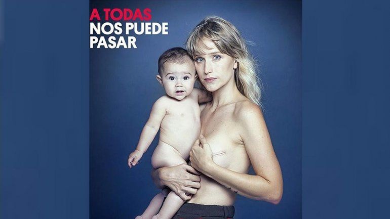 La impactante foto de Brenda Gandini para concientizar sobre el cáncer de mama