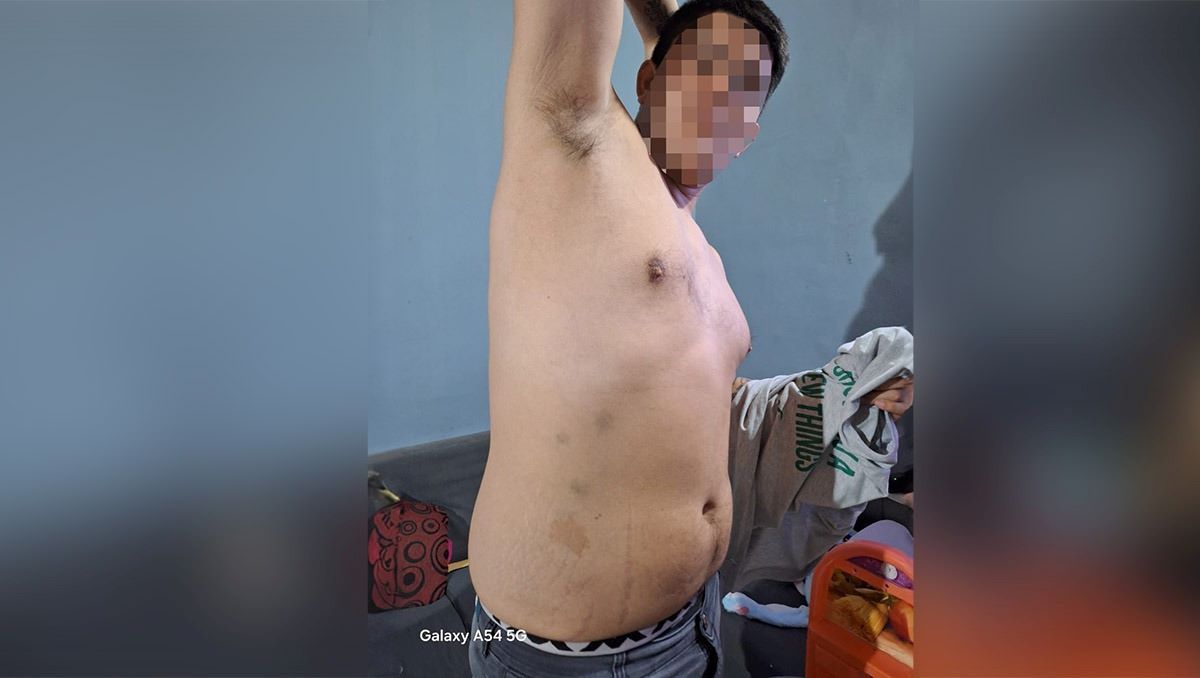 El muchacho denunció que policías le pegaron en la vía pública y luego en la Comisaría 79. Hizo la denuncia en la Fiscalía.&nbsp;