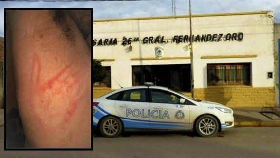 Denuncia que lo golpearon por violar la cuarentena