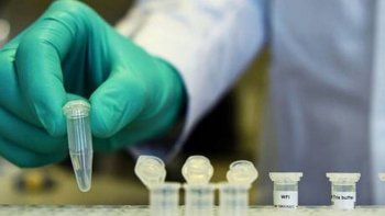 aprueban protocolo de plasma y comenzara a aplicarse