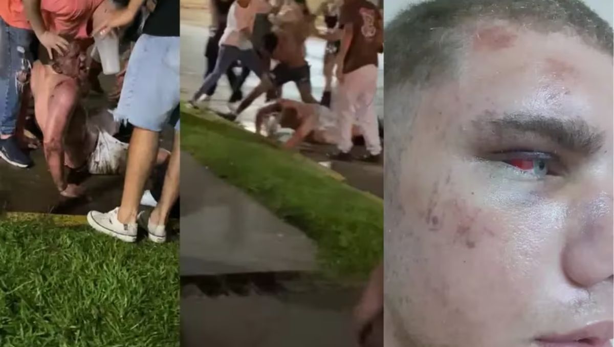 Brutal golpiza a un adolescente de 17 años a la salida de un boliche