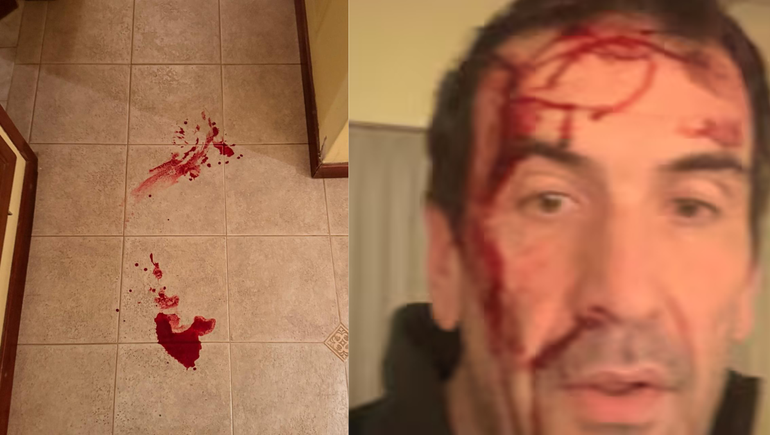 Tras el violento robo, Pablo Cervi y su familia tienen consigna policial: ¿Qué se sabe de la investigación?