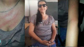 brutal agresion al aire: el dueno de una radio ataco a una locutora brutal agresion al aire: el dueno de una radio ataco a una locutora
