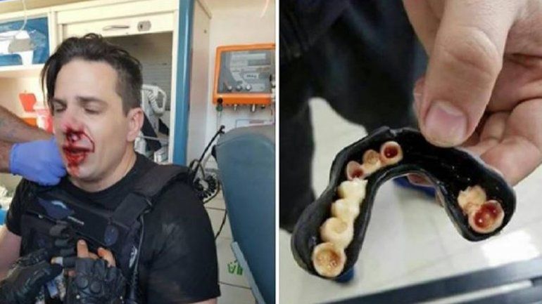 Las imágenes de la violencia en el Congreso que se viralizaron y eran falsas