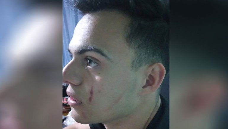 Escándalo: les pegaron con termos y piñas a árbtrios de inferiores