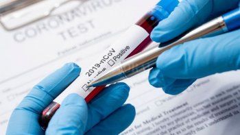 coronavirus: hubo 3 nuevos contagios y 5 altas en cipolletti