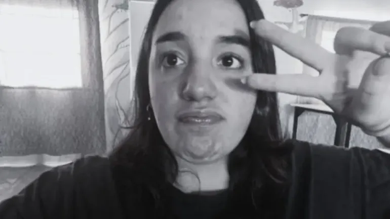 Astrid hab&iacute;a sobrevivido inicialmente pero luego falleci&oacute; en el Hospital.