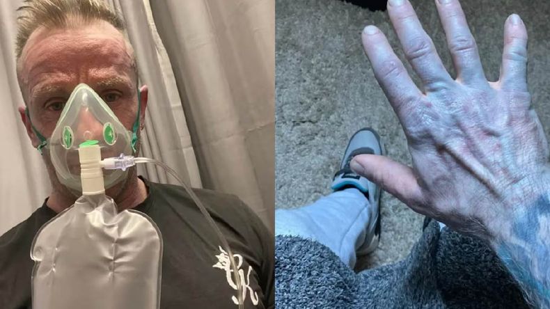 Tenía la piel azul l de pies a cabeza, al igual que los personajes de la pelicula Avatar de James Cameron.