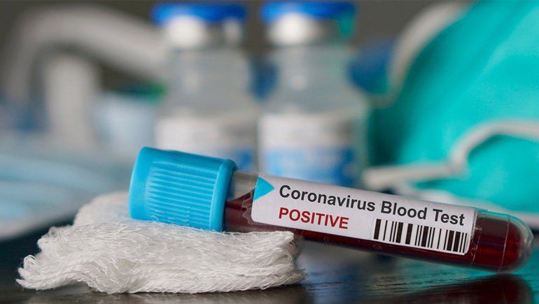 Murió un hombre de 89 años en Buenos Aires y son 44 los muertos por coronavirus en el país