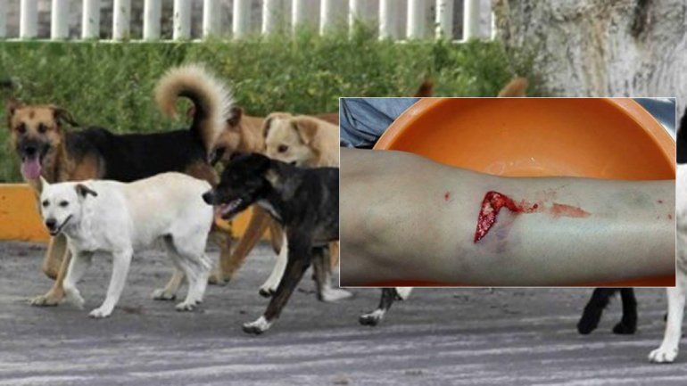 Feroz ataque en el centro: perros mordieron las piernas de una mujer que iba en moto