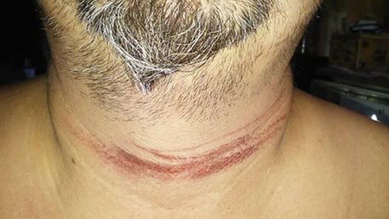 Iba en moto y casi muere decapitado por un cable