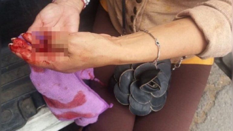 Le arrancó dos dedos a su amiga y se los comió: ¿estaba poseída?