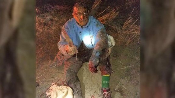 El campesino contó cómo fue la pelea contra el puma