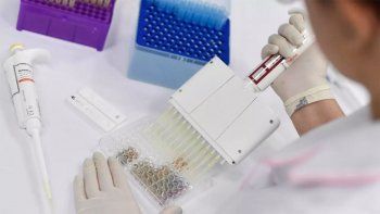 argentina compro 22 millones de dosis de la vacuna de oxford