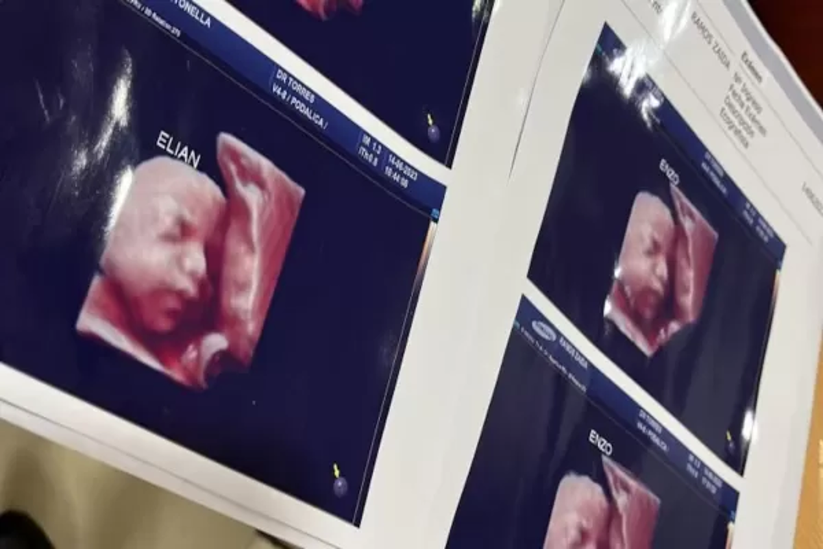 Una clínica entregaba la misma ecografía a sus pacientes embarazadas