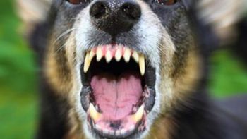 El perro atacó a la niña, y el dueño del animal admitió su responsabilidad. 