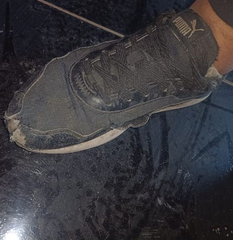 Un adolescente de 14 años de edad tenía, como único calzado, un par de zapatillas al borde de la extinción, como muestra la imagen. Y es que las usaba mucho, ya que debe caminar bastante para ir a estudiar. Por fortuna, una personas generosa le compró zapatillas nuevas.