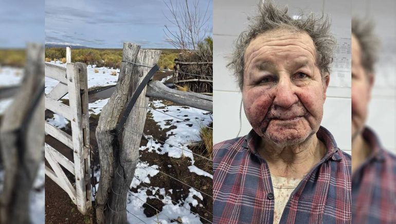 Ataque brutal en el campo: desconocidos golpearon y robaron a un criancero de 72 años