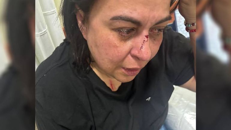 Una docente de la UNRN fue agredida en la vía pública. Foto: Gentileza.