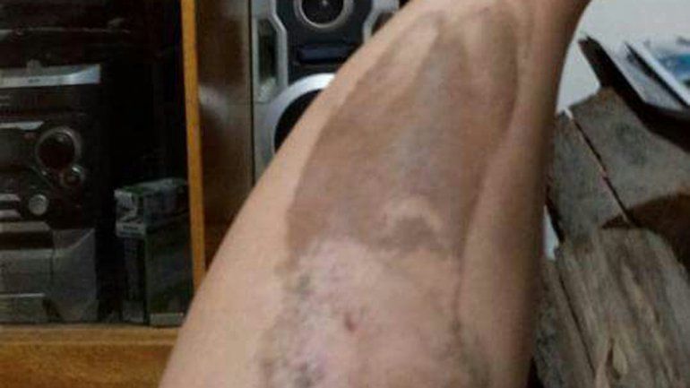 La mujer agredida por el chino sufrió lesiones en varias partes del cuerpo.