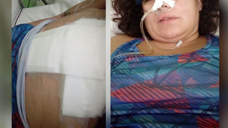 Le dieron tres tiros a una mujer por defender a su hijo en Neuquén