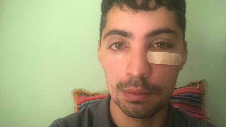 El joven golpeado por el mánager de Sele Vera todavía no puede volver a trabajar