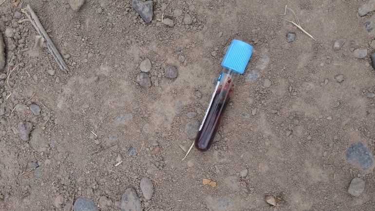 Hallaron residuos patógenos tirados por las calles de Cinco Saltos