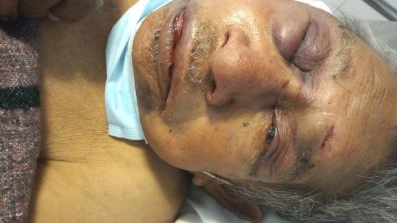 El abuelo golpeado por delincuentes ahora se contagió Covid