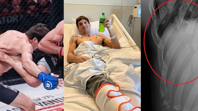 La patada más brutal de la historia: 5 costillas rotas y pulmón perforado