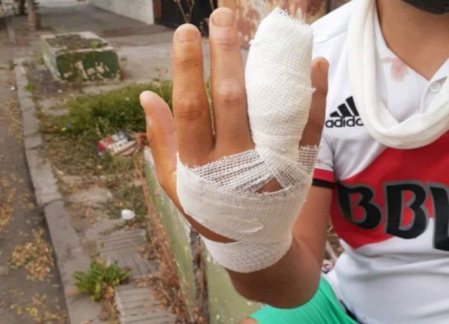 Fernando perdió parte de su dedo.&nbsp;