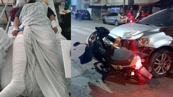 El joven permanece internado tras ser embestido por un auto.