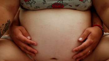 cirugia estetica sobre una cicatriz la dejo peor que antes