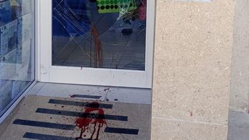 El ladrón rompió el vidrio de una patada con la pierna derecha. Pero se lastimó con el filo del cristal y tuvo que reperir atención en el hospital. El ladrón rompió el vidrio de una patada con la pierna derecha. Pero se lastimó con el filo del cristal y tuvo que reperir atención en el hospital.