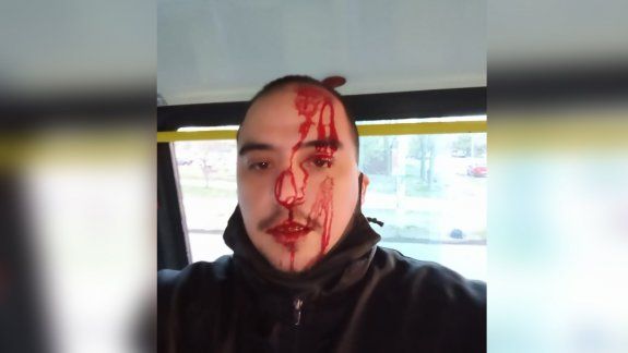 Quiso viajar sin pagar y le partió la cabeza al chofer