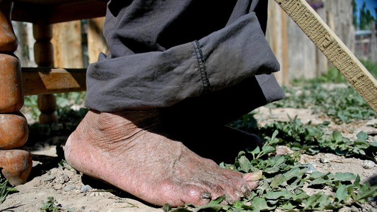 Sin perdón: mantenía a su mamá encerrada y sin comida