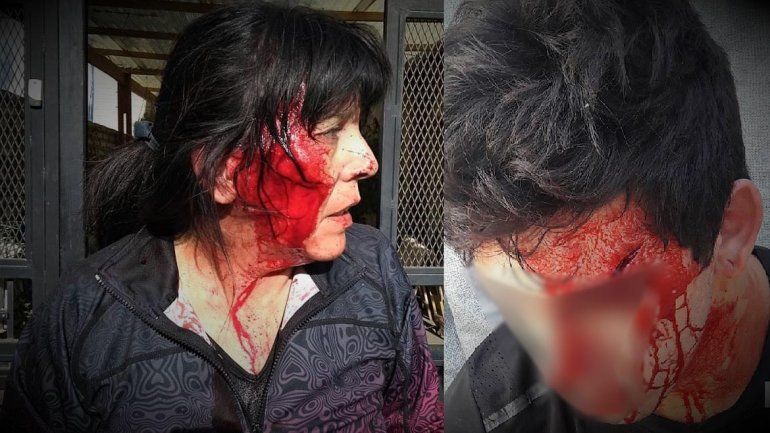 El video de la brutal agresión de una familia de boxeadores a una mujer del Don Bosco