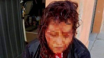 dramatico relato de la mujer que asistio a la turista violada 