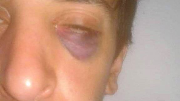 Motochorros casi mataron a golpes a un joven