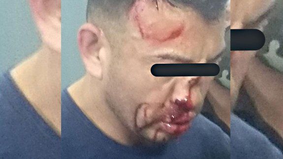 El fisicoculturista femicida recibió una brutal paliza