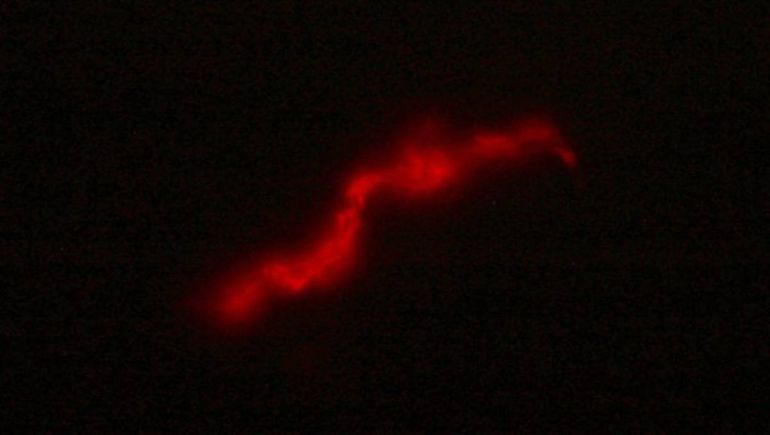 El test detecta la bacteria de la TB en la muestra de esputo de un paciente y produce una proteína fluorescente.