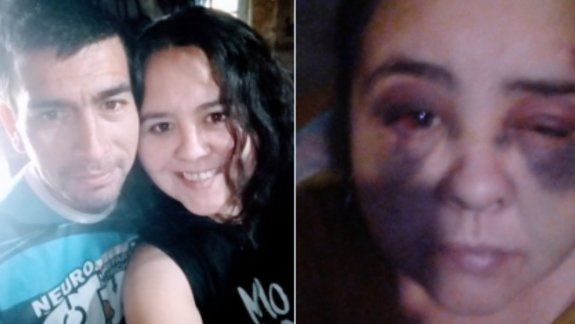 La joven neuquina reside en Chos Malal. Viralizó su foto para terminar con su calvario.&nbsp;