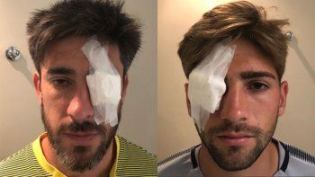 como quedaron los jugadores perez y lamardo tras los incidentes