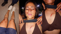 La mujer sufrió golpes de puño en la cabeza, lesiones y cortes en los brazos y el pecho con el machete. Además, su cuñada intentó chocarla con su auto. La mujer sufrió golpes de puño en la cabeza, lesiones y cortes en los brazos y el pecho con el machete. Además, su cuñada intentó chocarla con su auto.
