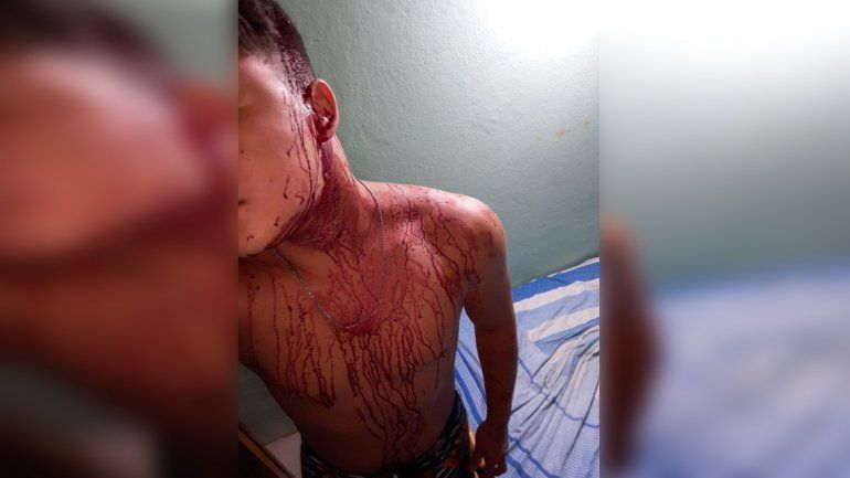 El policía acusado de amenazar a vecinos dio su versión de los hechos