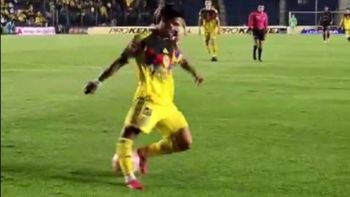 La escalofriante lesión de un jugador chileno que estremeció a todos | LMCipolletti.com La escalofriante lesión de un jugador chileno que estremeció a todos
