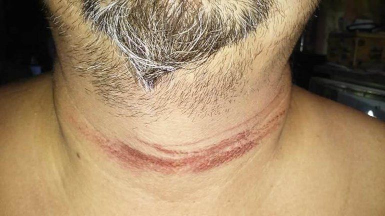 Iba en moto y casi muere decapitado por un cable a baja altura